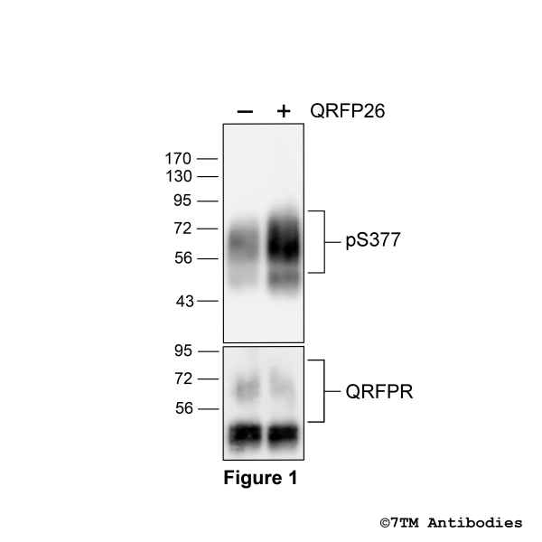 Agonist-induced Serine377 phosphorylation of QRFP Receptor