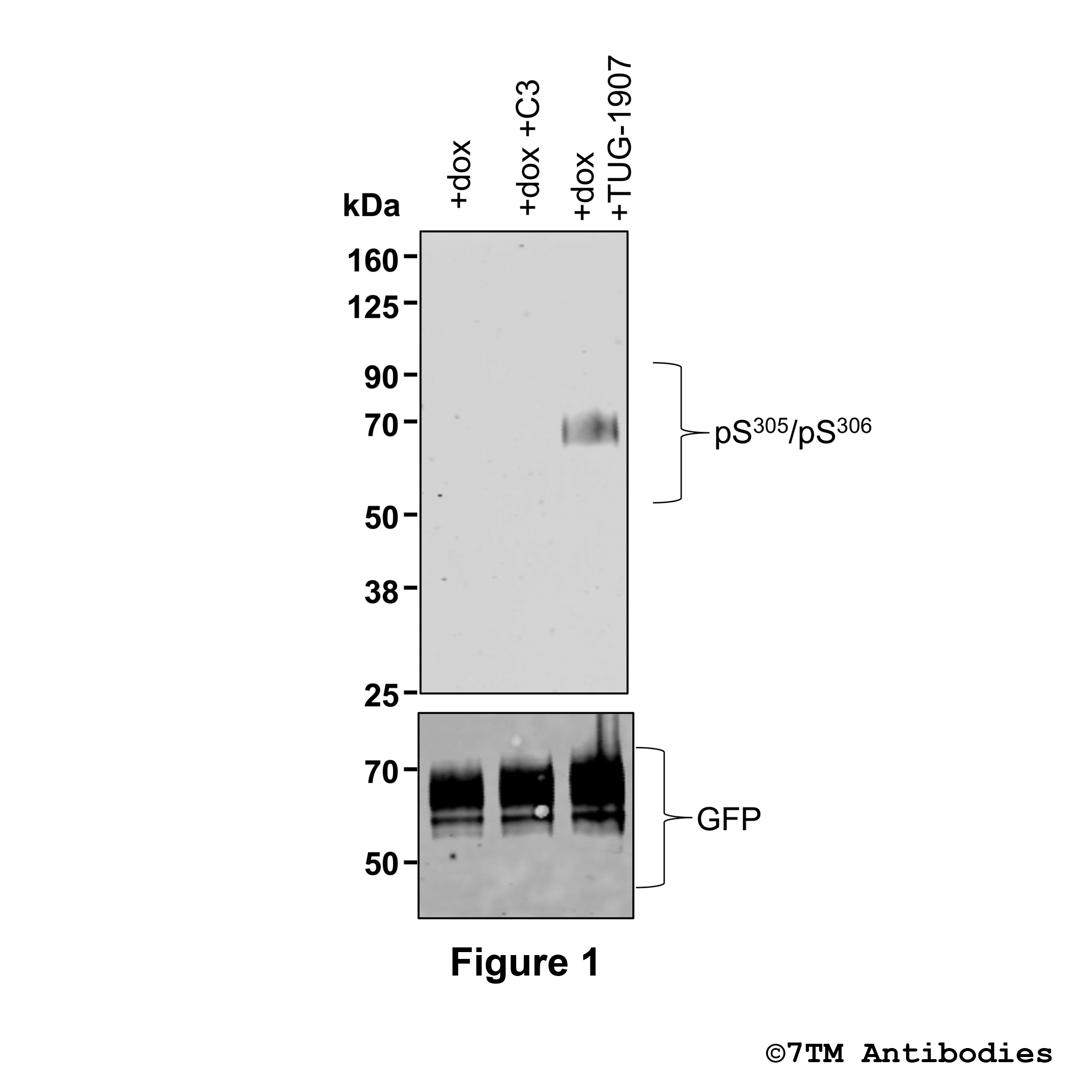 Free Fatty Acid Receptor 3 Antibodies | 7TM Antibodies