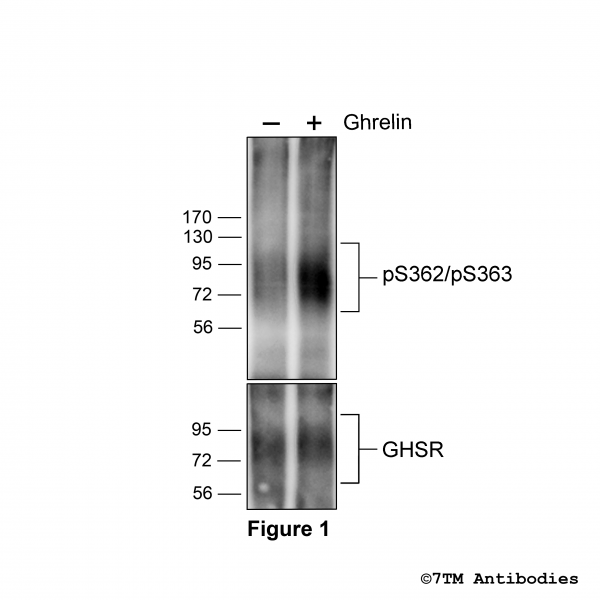 Agonist-induced Serine362/Serine363 phosphorylation of Ghrelin Receptor