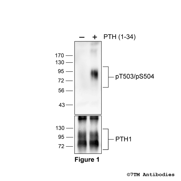Agonist-induced Threonine503/Serine504 phosphorylation of the Parathyroid Hormone Receptor 1
