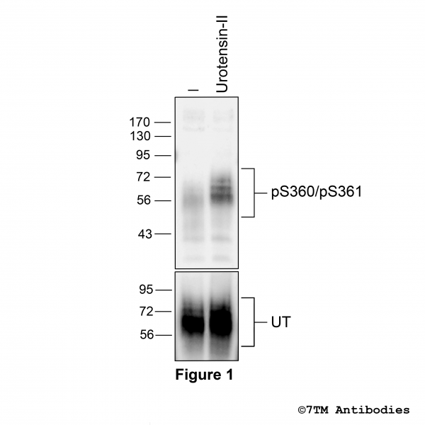 Agonist-induced Serine360/Serine361 phosphorylation of the Urotensin Receptor