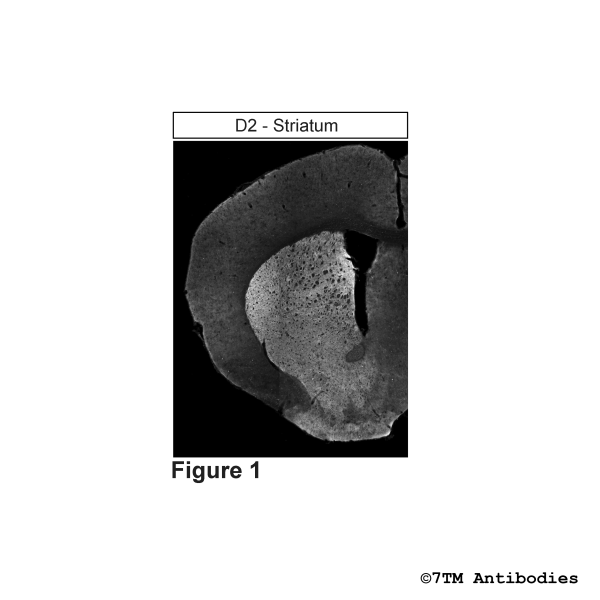 Immunohistochemical identification of Dopamine Receptor 1 and Dopamine Receptor 2 in striatum