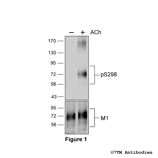Agonist-induced Serine298 phosphorylation of the M1 Muscarinic Acetylcholine Receptor