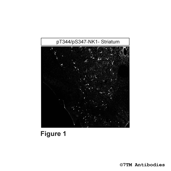 pT344/pS347-NK1 (IHC-grade phospho-Tachykinin Receptor 1 Antibody)