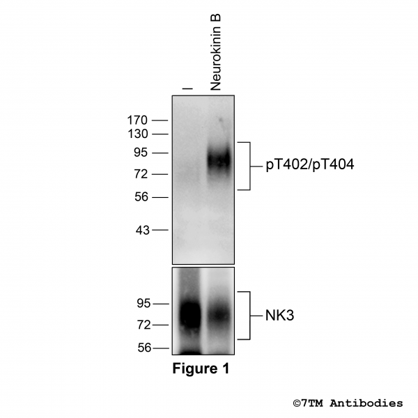 Agonist-induced Threonine402/Threonine404 phosphorylation of the NK 3 Receptor.