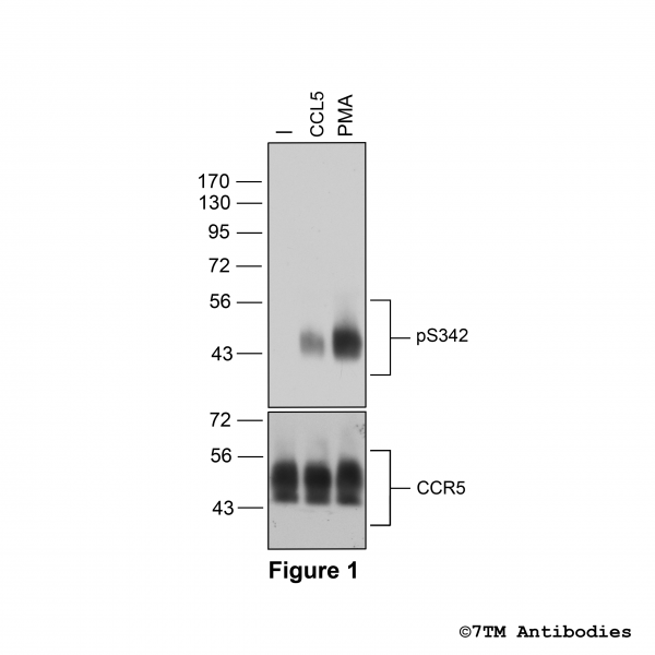 Agonist-induced Serine342 phosphorylation of the Chemokine Receptor 5