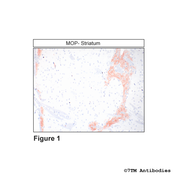 Immunohistochemical identification of µ-Opioid Receptor in Striatum
